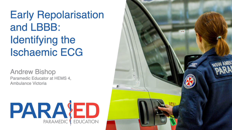 Early Repolarisation and LBBB: Identifying the Ischaemic ECG